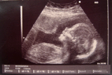 Announce Pregnancy